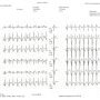 Exemple Tracé Cardiaque à 12 km/h