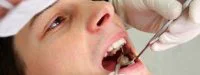 Quand les dents ébranlent… les tendons